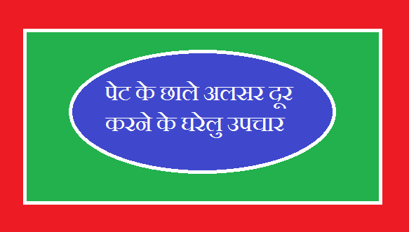 Pet ke chale ulcer door karne ke gharelu upchar in hindi